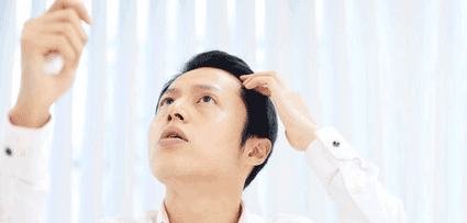 Hair Restoration Options