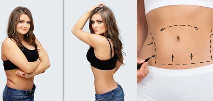 Body Reshaping